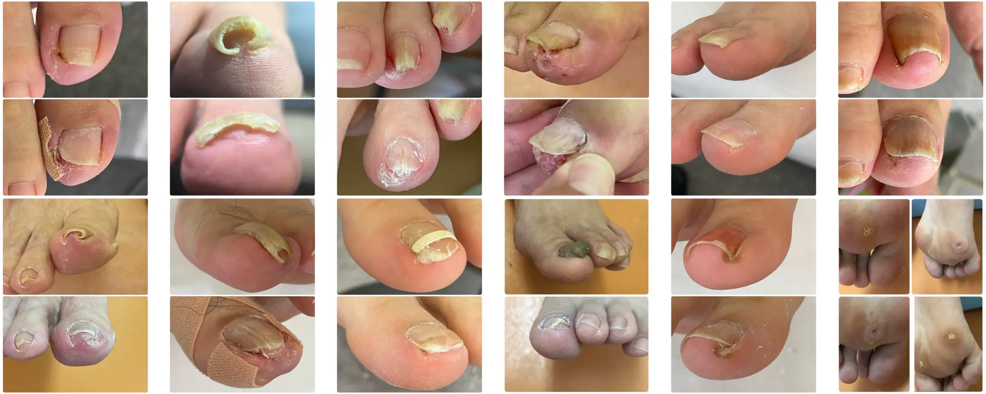 98.3%の方の痛みが初回で改善!!(2022年新規968人中952人)